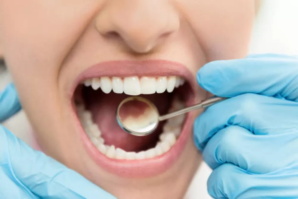 Implantar diente con poco hueso en Malasaña